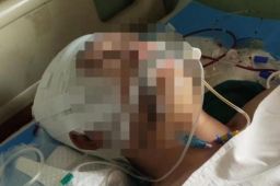 15岁男生遭老师殴打后颅内血肿