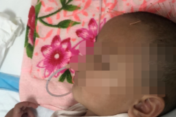 2岁女童参加喜宴后毒鼠强中毒