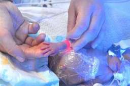 24岁产妇早产1女4男5胞胎