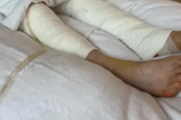 大爷杀猪被猪一脚蹬进开水盆