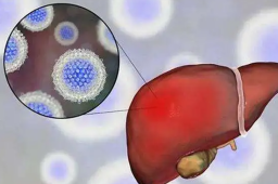 印尼现21例疑似不明原因肝炎病例