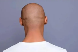 英法官裁定称男性“秃头”是性骚扰