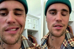 比伯患亨特氏综合征：右脸面瘫