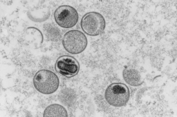 意大利男子同时感染猴痘新冠与艾滋