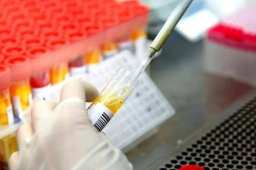 贵阳筛出301例阳性 出来的人去哪了