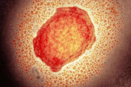 重庆现猴痘病例 吴尊友发文回应