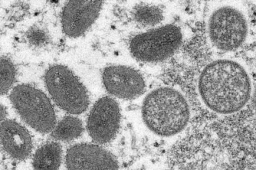 重庆猴痘病例与德国病毒高度同源