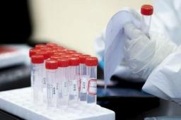 媒体：核酸一天两检不科学也不合规