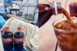 男子胃结石医生开药2大瓶可乐