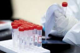 郑州新增本土64+294