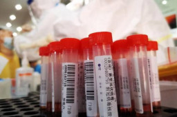 一支核酸检测病毒采样管多少钱