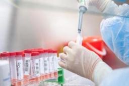 重庆1例死亡病例详情