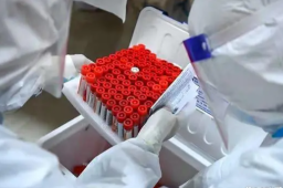 媒体：核酸检测乱象耗国库、伤民心