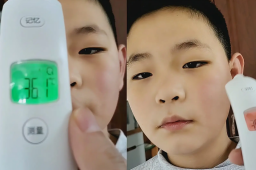 一家五口感染新冠儿子烧出阴阳脸