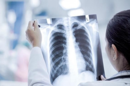 重症白肺死亡率40％以上