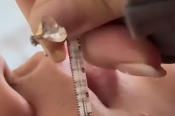 男子高烧近41度体温计贴脸狂飙