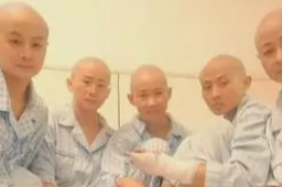 姐弟烧伤四位姨妈剃光头捐头皮
